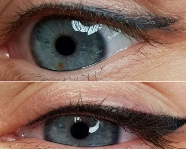 Перекрытие синих стрелок. Татуаж сделан более пяти лет назад нужно перекрывать или
выводить