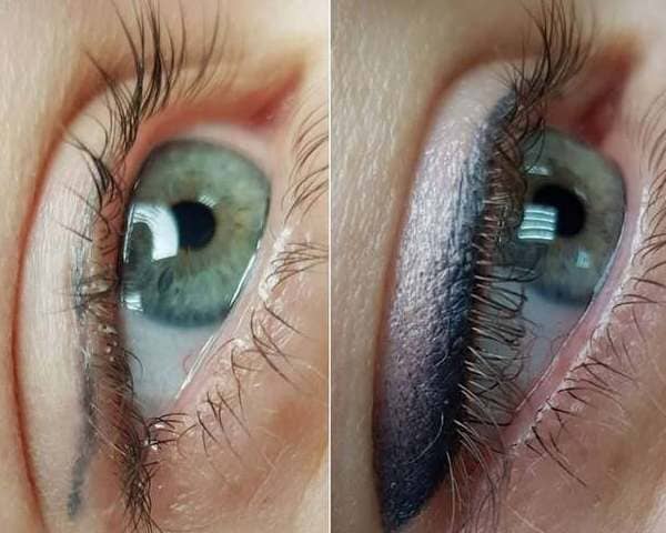 Перекрытие синей стрелки на стрелку с растушевкой зажившие через месяц