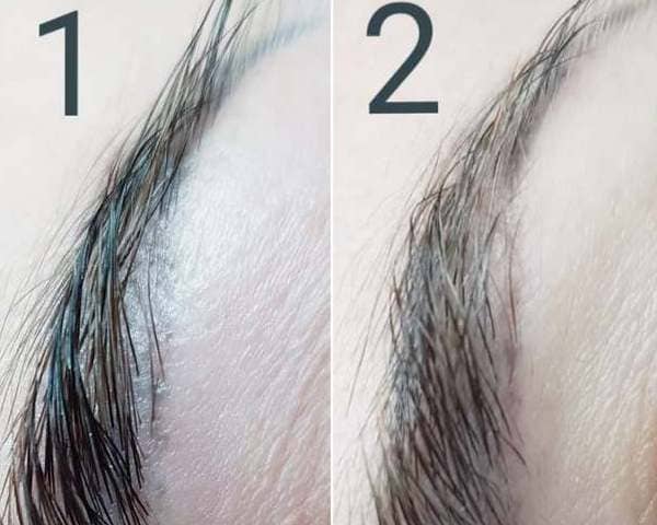 Удаление высветление бровей которые посинели после микроблейдинга
