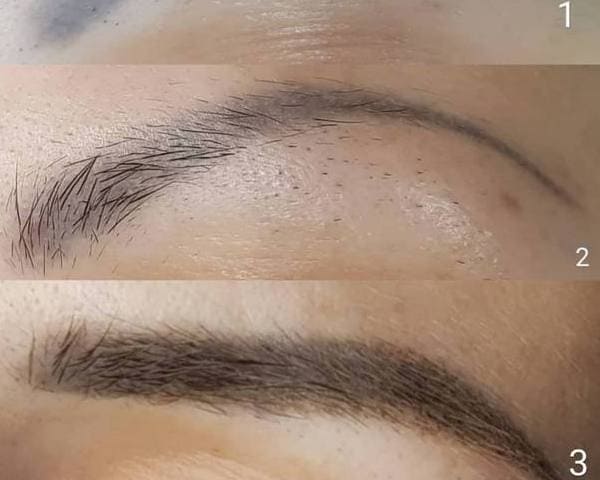 Процесс выведения бровей делается в два этапа. Первый этап это удаление старого татуажа
бровей, а второй это перекрытие старого татуажа бровей