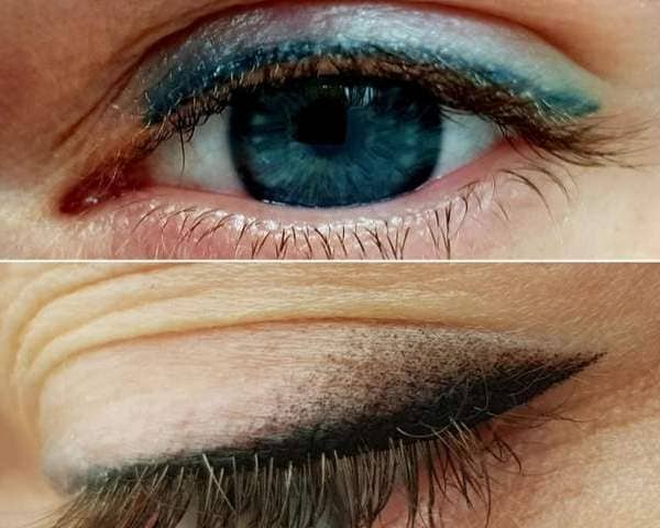 Старый синий татуаж нужно убирать перед нанесением нового